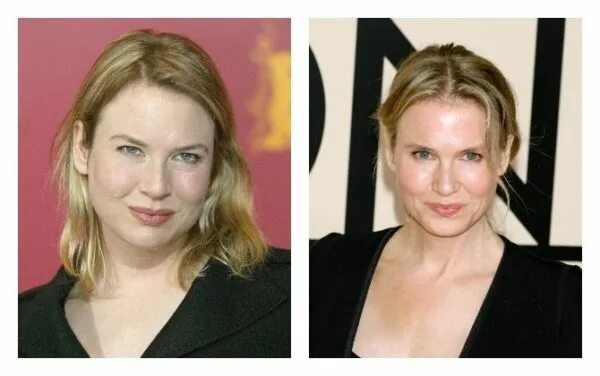 Рене зеллвегер фото пластика La dieta Renée Zellweger y su transformación. INCREÍBLE!