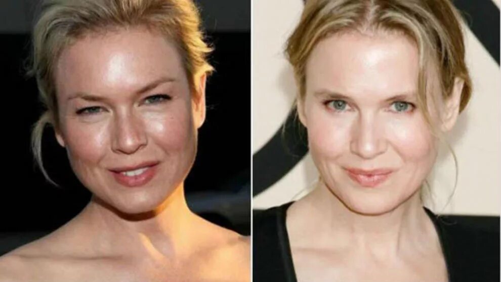 Рене зеллвегер фото пластика Renée zellweger MARCA.com