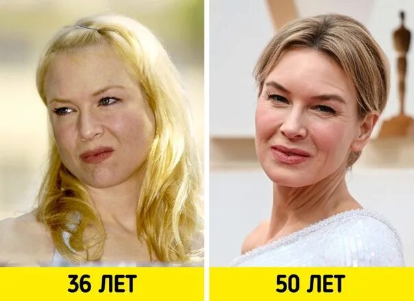 Рене зеллвегер фото пластика Renee Zellweger 2022 тогда / сейчас VK