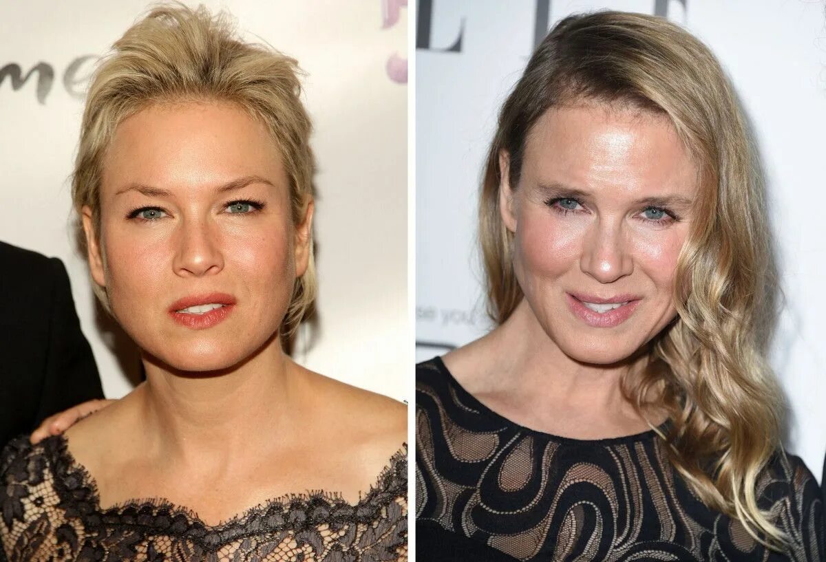 Рене зеллвегер фото сейчас после пластики Renée Zellweger, Before and After Bad celebrity plastic surgery, Plastic surgery