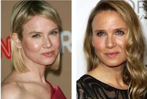 Рене зеллвегер фото сейчас после пластики A couple of years ago, Renée Zellweger was very surprised by the public. It can 