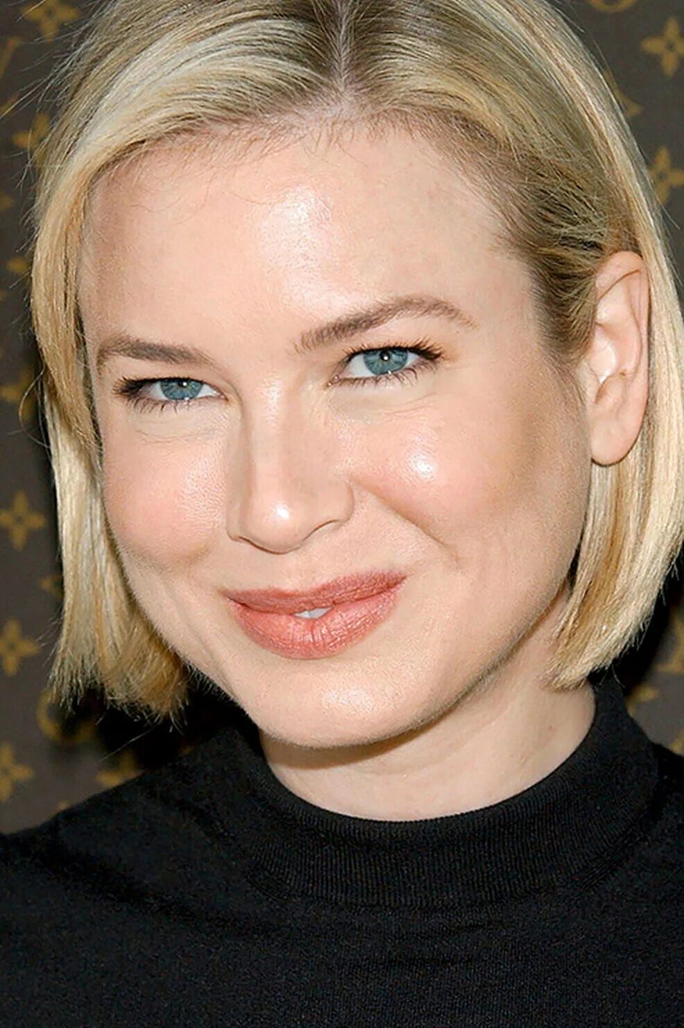 Renee Zellweger Plastic Surgery Before and After Pictures 2024