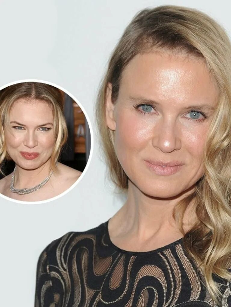 Рене зеллвегер как выглядит сейчас What the reaction to Renee Zellweger's new face says - Today's Parent