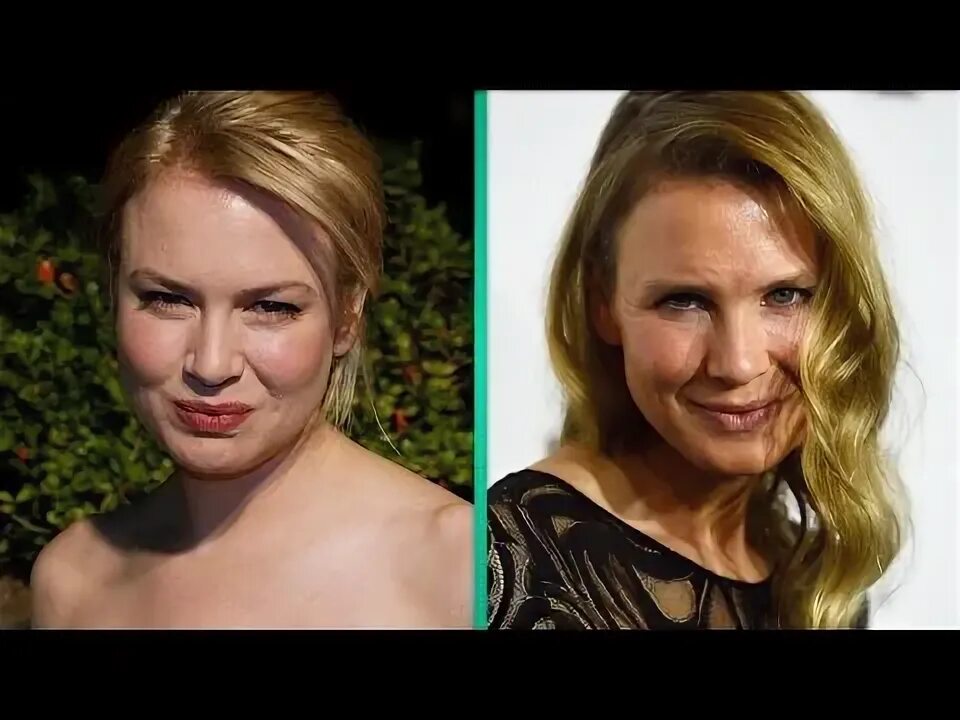 Рене зеллвегер как выглядит сейчас What Did Renee Zellweger Do to Her Face? Plastic Surgeon Weighs In - YouTube