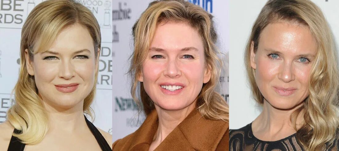 Рене зеллвегер как выглядит сейчас Renee Zellweger Plastic Surgery Before and After Pictures 2024