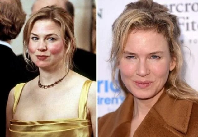 Рене зеллвегер как выглядит сейчас фото The Actors And Actresses From Bridget Jones, Oh How They Changed - Wow Gallery e