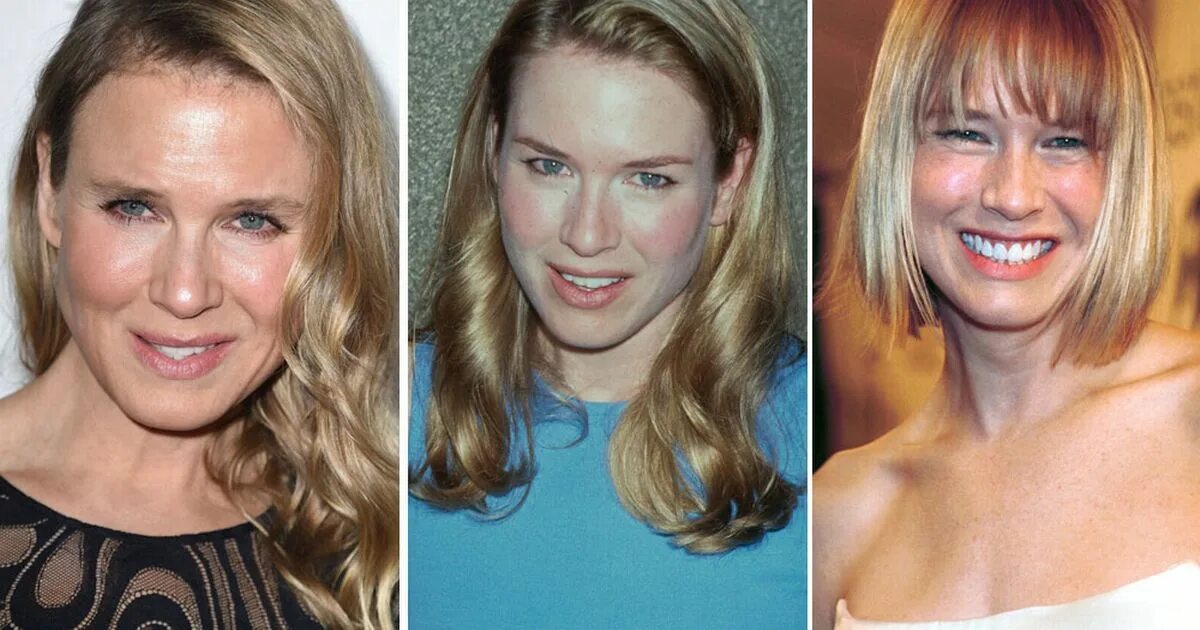 Рене зельвегер до и после пластики фото Renee Zellweger responds to criticism about her changing face: 'I'm glad folks t