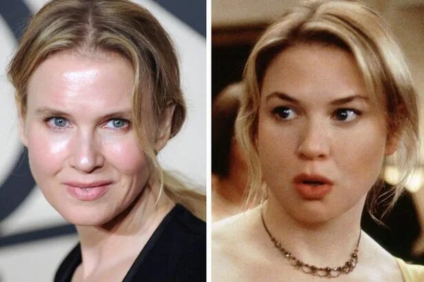 Рене зельвегер до и после пластики фото O novo rosto de Renée Zellweger