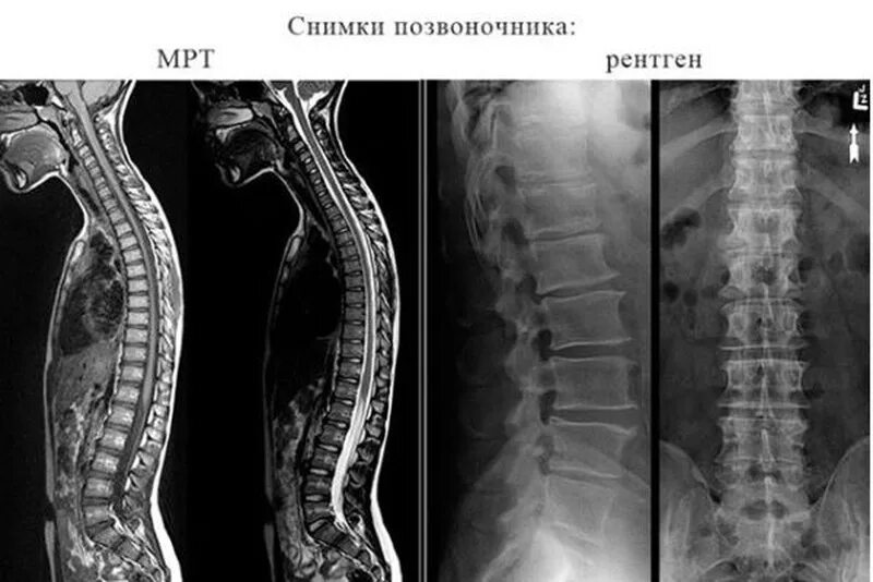 Рентген грудного отдела позвоночника фото Рентген - медицинский центр "МареМед"