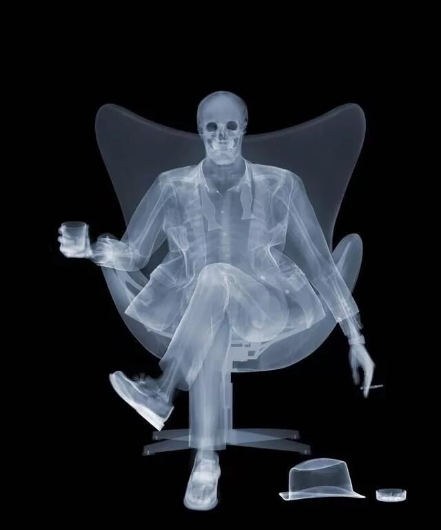 Рентген смешные фото Nick Veasey - Rat Pack - X ray Xray art, X ray, Prints