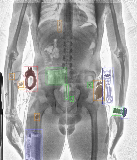 Рентген в аэропорту фото Файл:Artificial Intelligence for X-ray inspection.png - Википедия