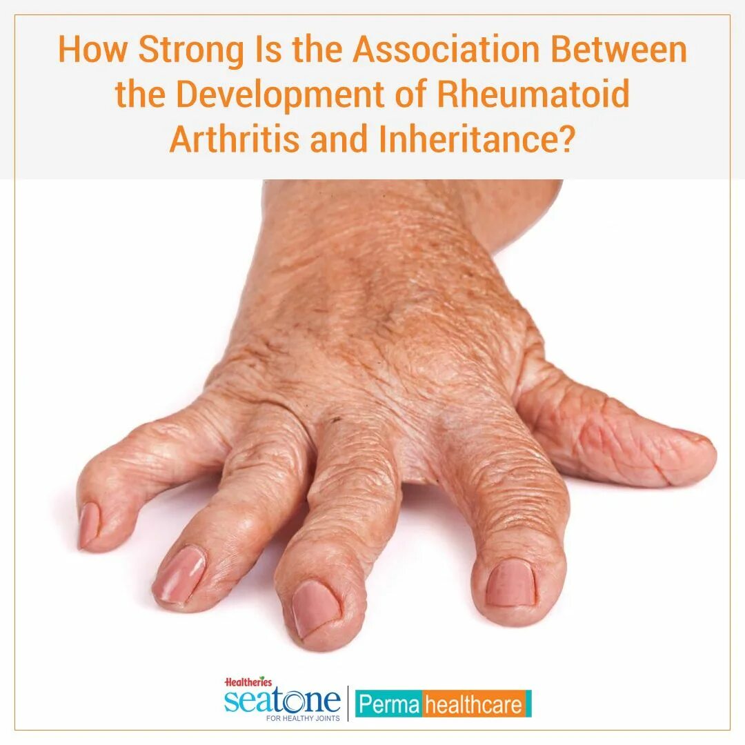 Ревматоидный артрит симптомы фото Pin on Rheumatoid Arthritis Treatment in India