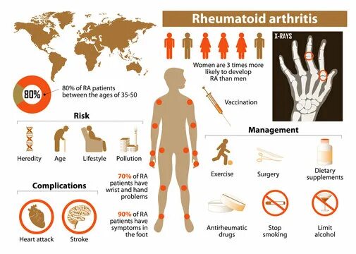 Ревматоидный артрит симптомы у женщин фото Arthritis Icon Зображення - огляд 9,895 Стокові фото, векторні зображення й віде