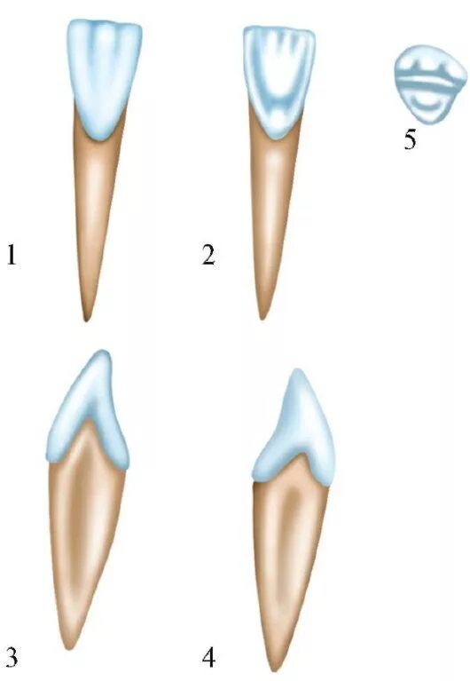 Резец зуб нижний как выглядит 4.1. Анатомическое строение зубов